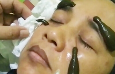 Terapi-pengobatan-lintah-pulihjati-hca-holistik Terapi-pengobatan-lintah-pulihjati-hca-holistik